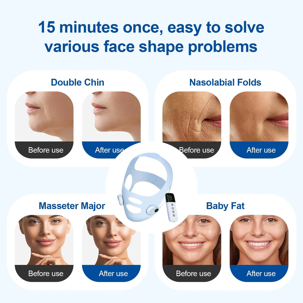 V Line Face Slimming Strap